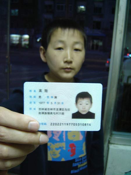 30岁男子13岁相貌 发育迟缓苦寻病因