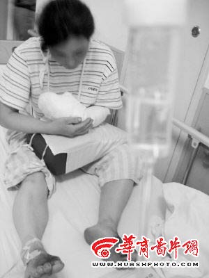 讨薪女赌气剁断自己手如今后悔(图)