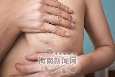 女孩因隆胸不当可能被切除乳房(图)
