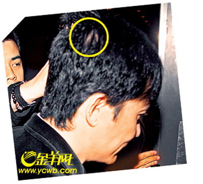 李嘉欣暗讽刘嘉玲梁朝伟为情脱发冒暗疮(组图)