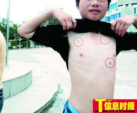 少年找工作受骗被逼抢劫 拒绝行抢挨皮带抽打