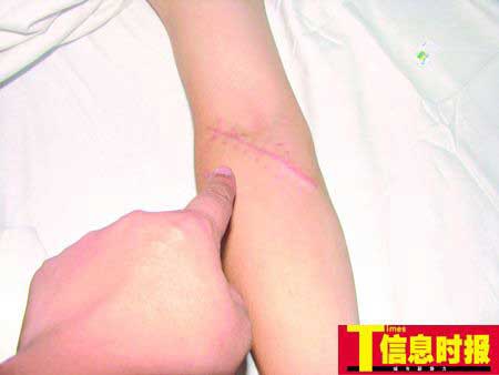 广东摩的司机被误认劫匪遭乱棍打死(组图)