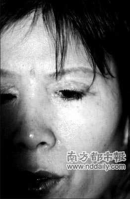 女子双眼皮手术失败致3年无法闭眼(图)_双眼皮 手术