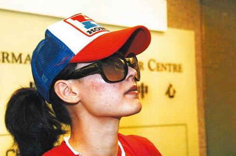 谢贤否认流产说 张柏芝辣椒过敏一脸红疹