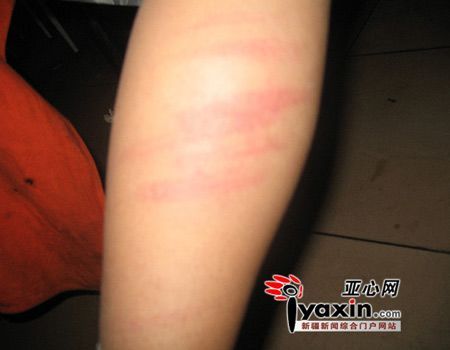 新疆石河子福利院孩子集体遭暴打(组图)