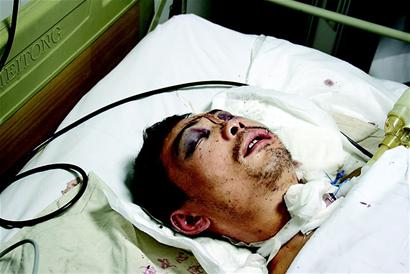 男子凌晨失足坠下天桥 昏迷不醒未脱离危险期