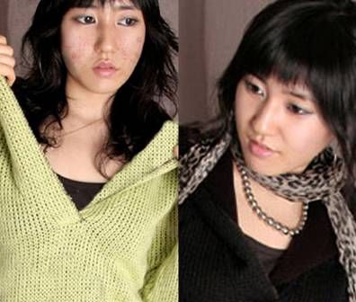 腾讯曝光<em>丑女</em>大翻身的战痘高招_高招 <em>丑女</em> 芦