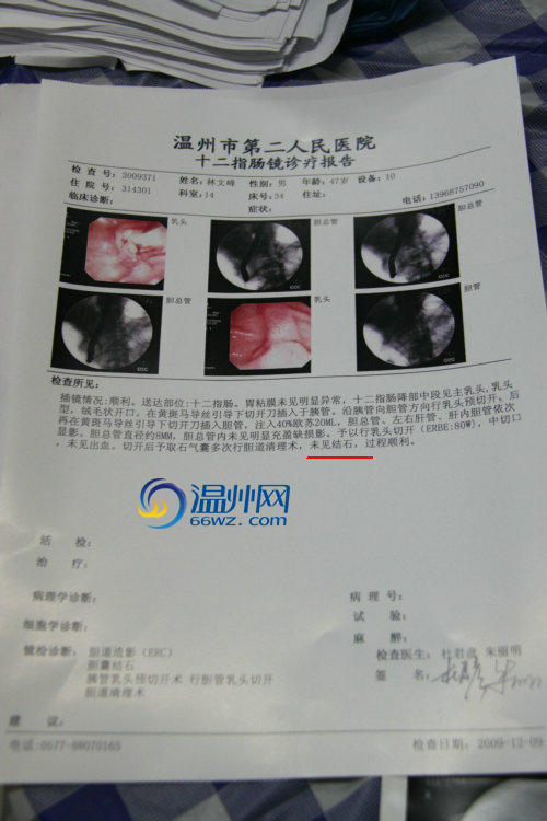 12月9号的肠镜诊疗报告未见结石.