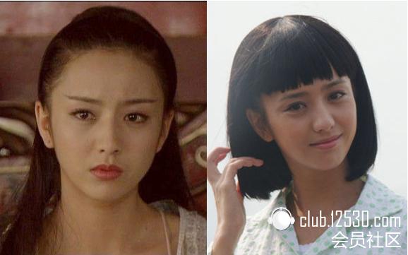 baby周迅的发际线