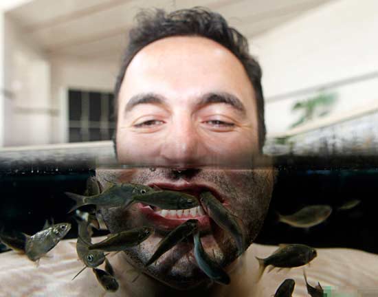 小心温泉鱼给你“衔”来皮肤炎症-+健康频道[温州网]