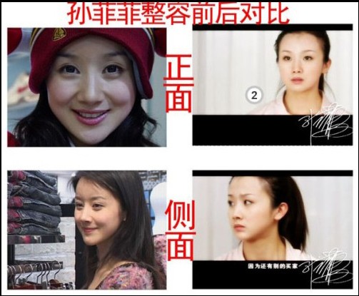 <em>孙菲菲</em>《宫2》被指面瘫 疑是<em>整容前后</em>家居照P