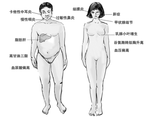 温州人最新体检报告出炉 三体检中心检出疾病排名