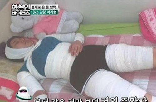 韩国绷带姐瘦20斤非长远之计