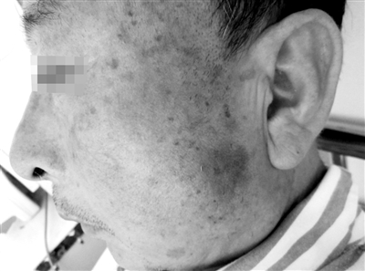 永嘉一村支书违建被举报 闯入村民家中殴打老人