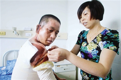 火中救人保安周震寰将出院回乡 最感谢温州好心人