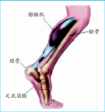 平足不等于平足症