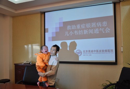 北京儿童医院皮肤科主任赵佩云教授等专家的联合会诊