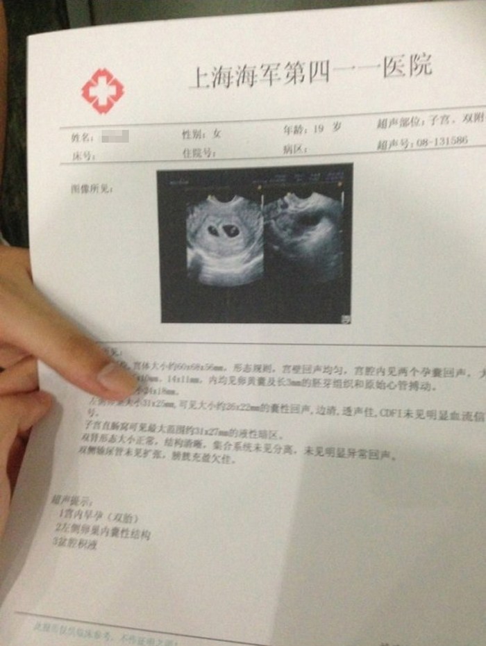 9月25日消息:发觉自己未婚先孕,竟然在网络上晒出验孕棒及b超证明照片