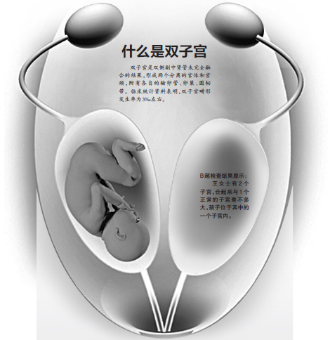 高分,女友怀孕两个月了,准备结婚,但是她不接受我父