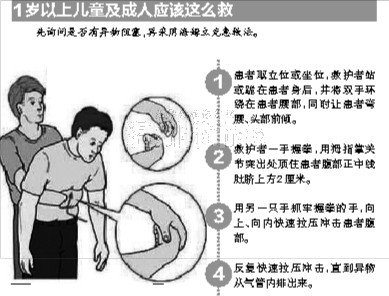 3岁宝宝啃苹果气管卡住呼吸心跳停止仍在抢救