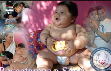 组图：哥伦比亚8个月宝宝重达40斤 住院减肥