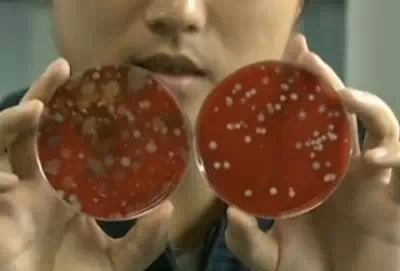 几乎是所有的手机细菌样本的污染情况都要比atm机的被污染情况要严重