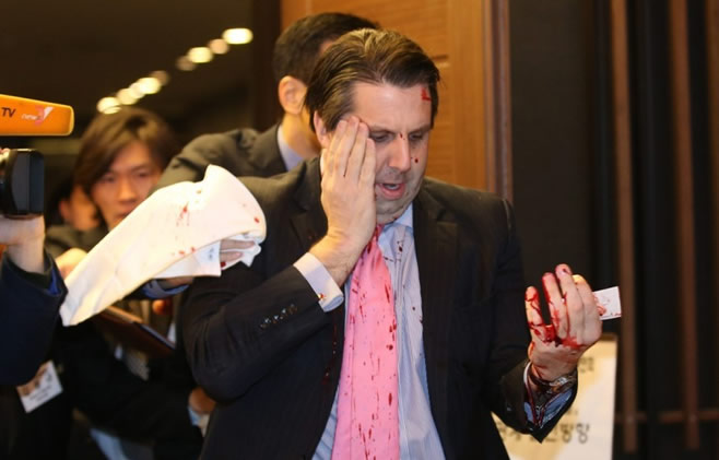 美驻韩大使脸部遭不明武装分子袭击受伤严重