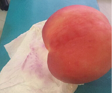 ���δ�ϴ�ʳ��Ϻ�ɫ ���Ƿ�������Ⱦɫ���ӡ�