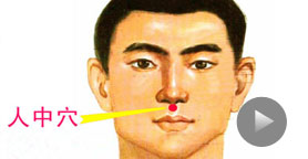 中暑了怎么办?掐人中抢救方法不可取