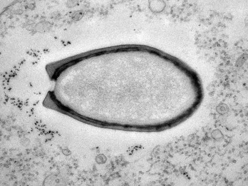 西伯利亚冻土中现史前巨型病毒 仍具有感染性(图)