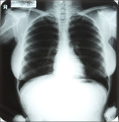 玛丽莲·梦露X光胸片将被拍卖 轮廓清晰望卖高
