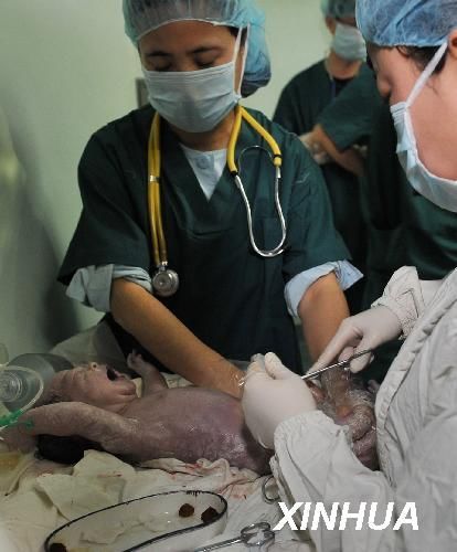 宁夏首例睾丸穿刺试管婴儿诞生(2)(图)