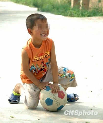 图文:7龄童因血铅超标一年多仅长高1厘米_图文