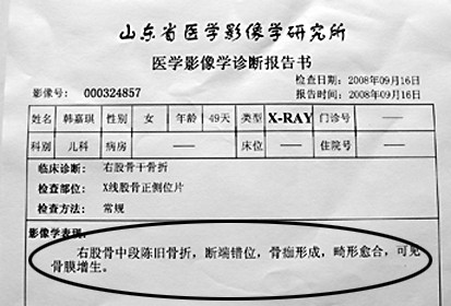 脚踝骨折诊断证明书图片