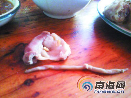 粉腸中吃出9釐米寄生蟲 食客嘔吐老闆開罵(圖)