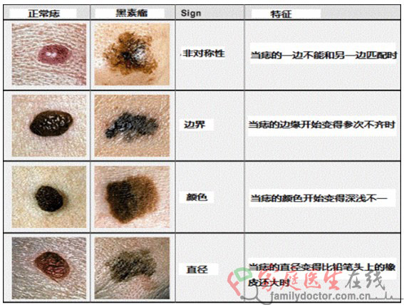 点痣后不能吃酱油是千年谣言