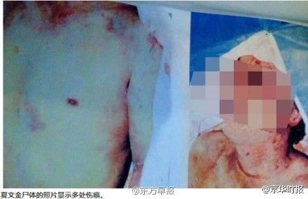 尸体照片显示多处伤痕