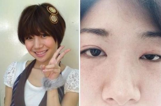 林沙织脸前后对比照