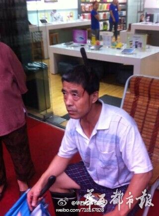 老人遭遇“天降飞刀” 只剩刀柄在头外 5旬老人遭遇“天降飞刀” 插入脑部10厘米险丧命
