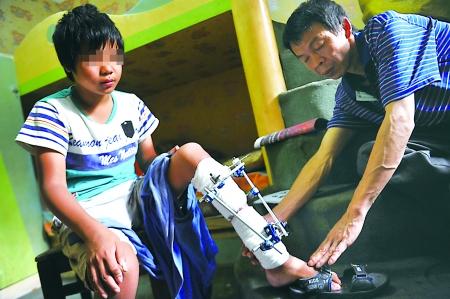 爸爸两年不工作 13岁"瘸腿"儿乞讨养活父子俩